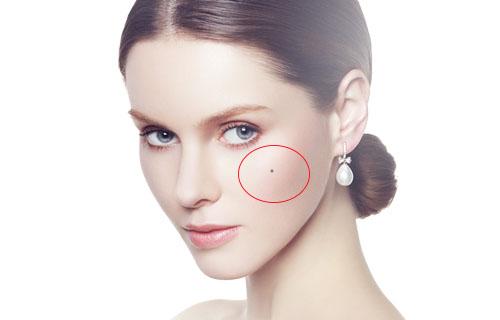 Phụ nữ có nốt ruồi ở 4 vị trí này, cả đời không lo cơm áo gạo tiền, bên ngoài dù sóng gió nhưng họ vẫn được ban phước lành - Ảnh 1.