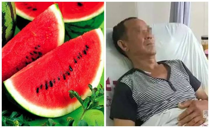 Người đàn ông phải cắt bỏ 70cm ruột non bị hoại tử do ăn dưa hấu để qua đêm - Ảnh 2. Người đàn ông phải cắt bỏ 70cm ruột non bị hoại tử do ăn dưa hấu để qua đêm - Ảnh 2.