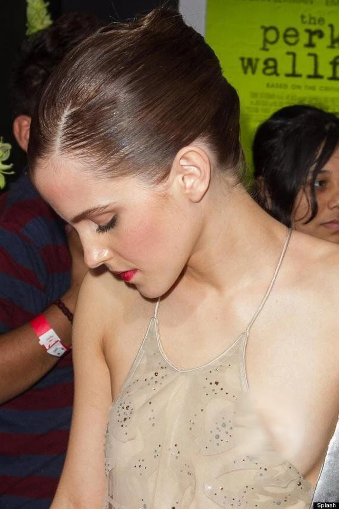 Always dressed elegantly, Emma Watson still had two "revealing" moments. that she never wants to remember again - Photo 6.