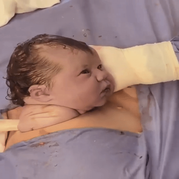 Cận cảnh thời khắc em bé chào đời khiến các mẹ sinh mổ chực trào nước mắt - Ảnh 2.