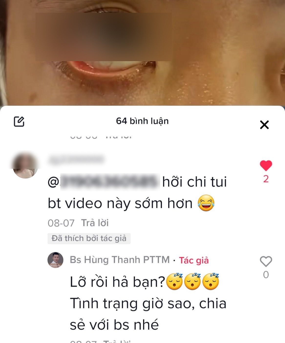 Tr&agrave;o lưu mắt giọt lệ Trung Hoa đang l&agrave;m mưa l&agrave;m gi&oacute; được chuy&ecirc;n gia nhận định thế n&agrave;o? - Ảnh 3.