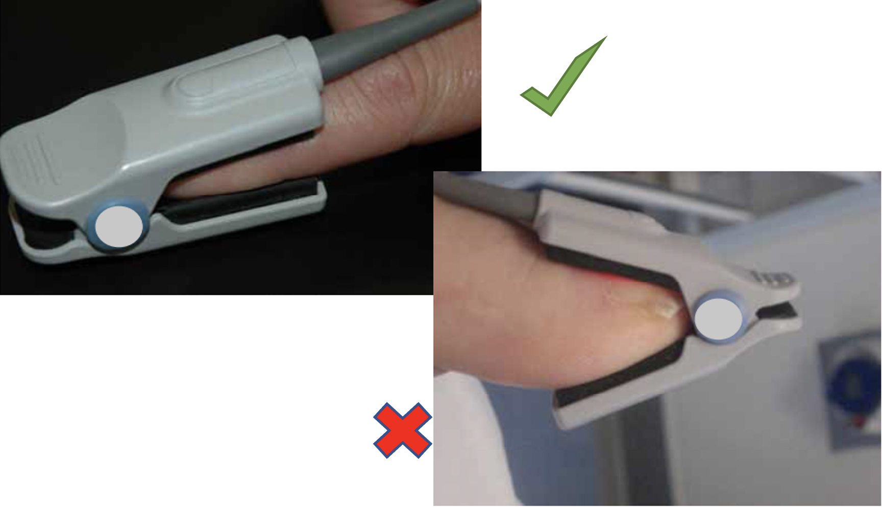 Cách chọn mua máy đo SpO2 giữa mùa dịch COVID-19