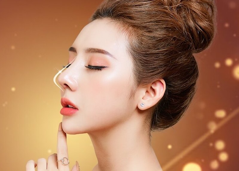 Mũi t&ocirc;i bị gồ th&igrave; cần chỉnh sửa những g&igrave; để sở hữu mũi đẹp, thanh t&uacute;? - Ảnh 4.