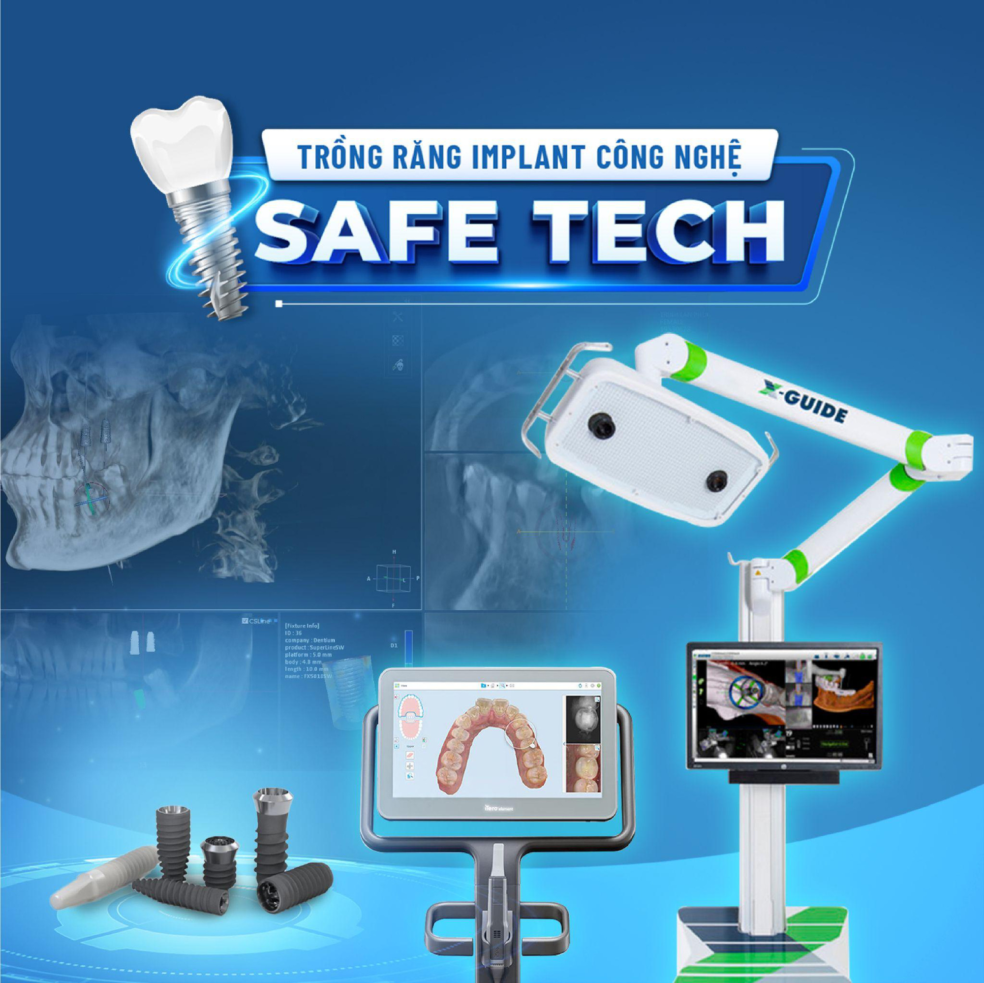 20 năm mất răng và hành trình tìm lại hạnh phúc nhờ trồng răng Implant - Ảnh 2. 20 năm mất răng và hành trình tìm lại hạnh phúc nhờ trồng răng Implant - Ảnh 2.