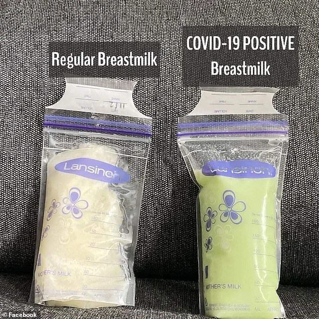 sữa mẹ bị nhiễm COVID-19 - Ảnh 1.