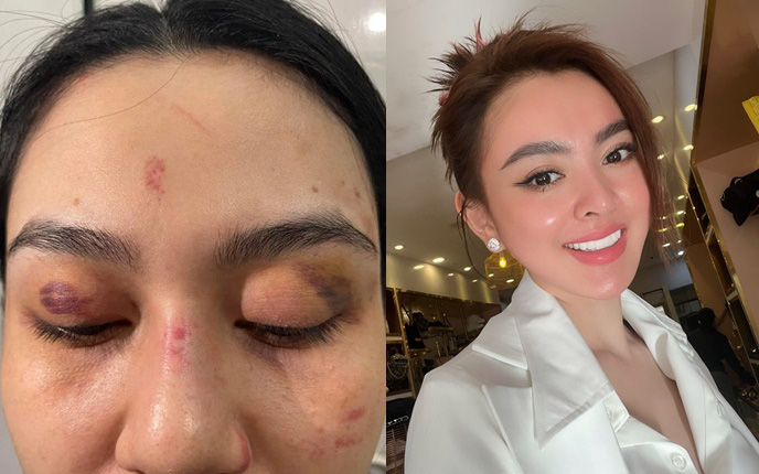 Người chị "xã hội" của Trần My bị đánh ở shop Trang Nemo lên tiếng: "Em tin pháp luật sẽ lấy lại công bằng cho em"