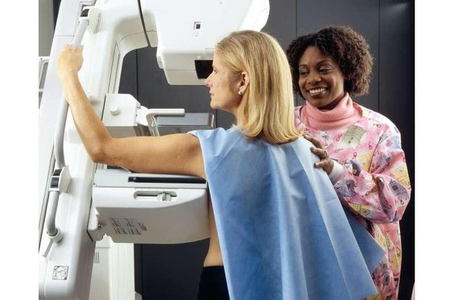 Nghiên cứu mới: Không cần thiết chụp X-quang tuyến vú quá sớm khi tầm soát ung thư - Ảnh 1.