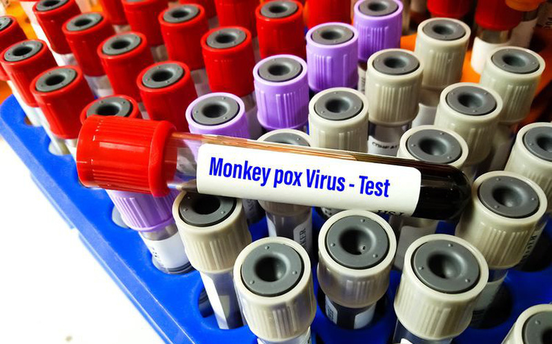 Trường hợp nổi mụn đỏ sau khi trở về từ Nam Phi tại Đắk Lắk âm tính với virus gây bệnh đậu mùa khỉ - Ảnh 1.