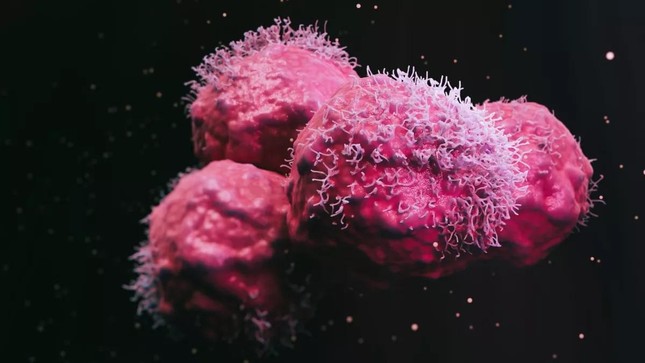 Người phụ nữ được chẩn đoán mắc 12 khối u có đột biến gien chưa từng thấy ở người - Ảnh 1.