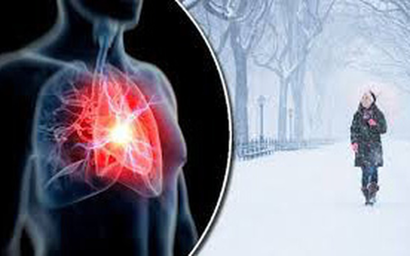 Bệnh đột quỵ gia tăng khi trời lạnh - dấu hiệu nhận biết và thời gian vàng điều trị - Ảnh 1.