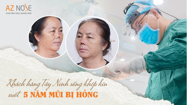 13 năm làm nghề và những ca nâng mũi ấn tượng của bác sĩ CKI. Nguyễn Hoàng Nam - Ảnh 2.