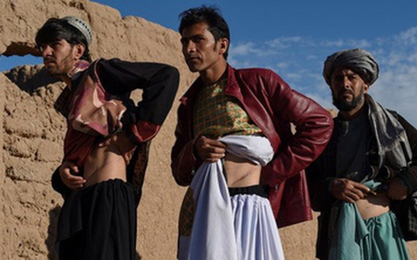 &lsquo;L&agrave;ng một thận&rsquo; ở Afghanistan - Ảnh 1.
