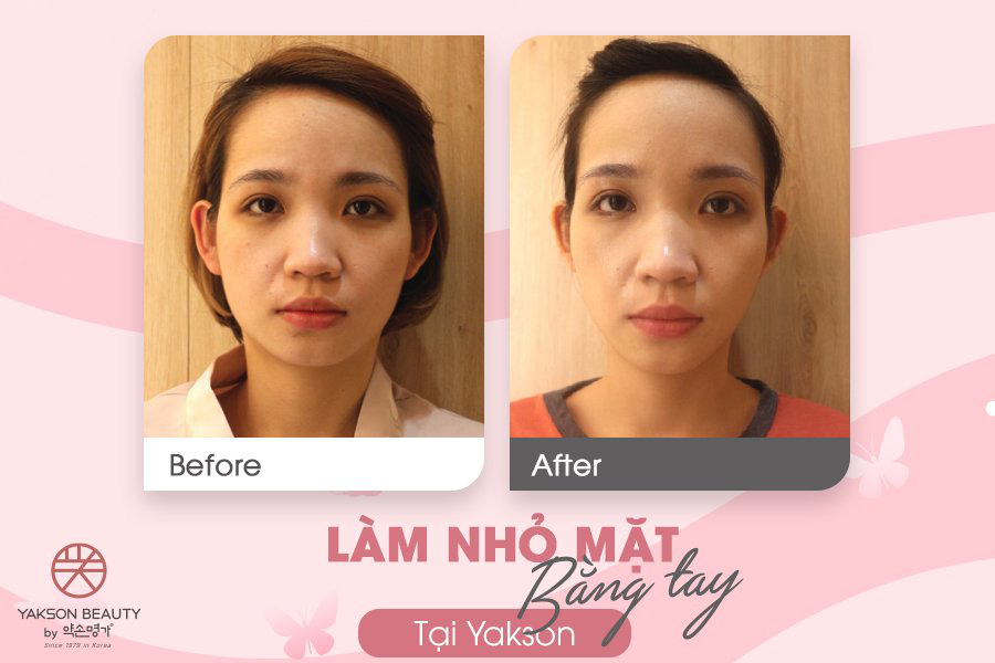 Golki v&agrave; c&acirc;u trả lời từ chuy&ecirc;n gia H&agrave;n Quốc - Ảnh 3.