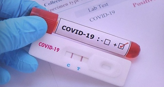 Tái nhiễm Covid-19, nhiều người nhanh trí làm ngay điều này để nhanh khỏi khiến bác sĩ &quot;kêu trời&quot; - Ảnh 3.