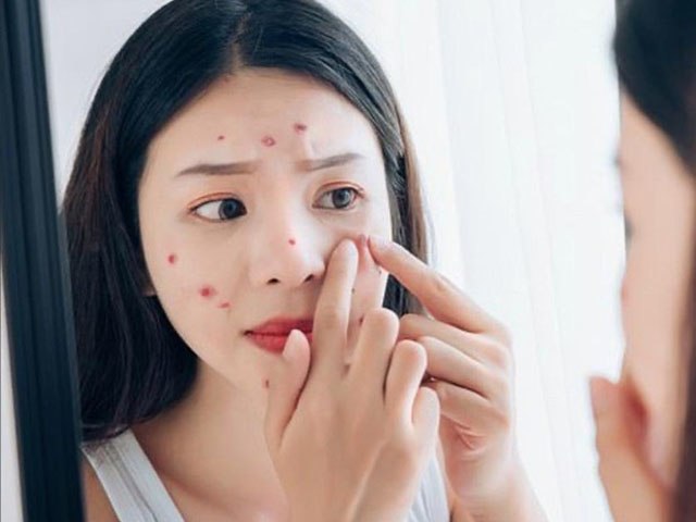 5 types of super acne water that pump collagen very well, women use it all the time in the summer, it is also super good for health - Photo 7.