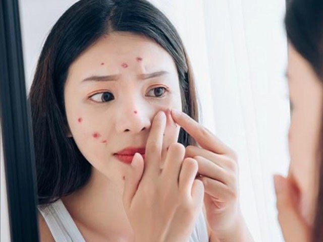 5 loại nước trị mụn siêu đỉnh lại bơm collagen cực tốt, chị em dùng đều vào mùa hè còn siêu tốt cho sức khỏe - Ảnh 7.