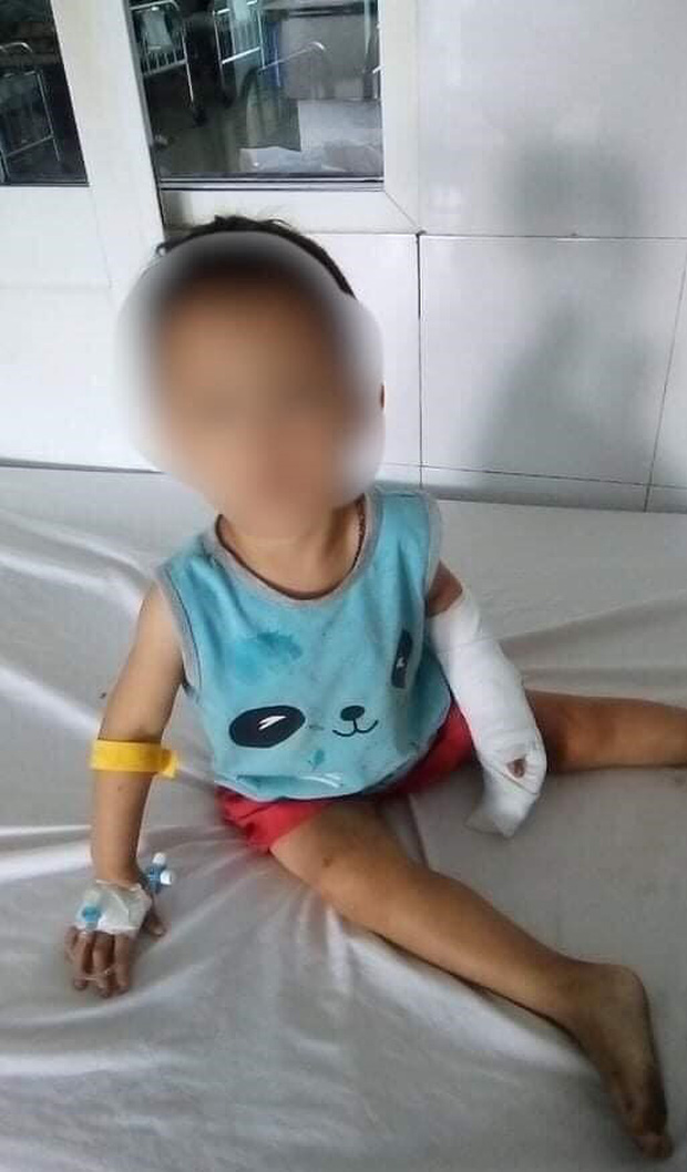 A 3-year-old girl was cut by her mother's lover with a razor blade - Photo 2.