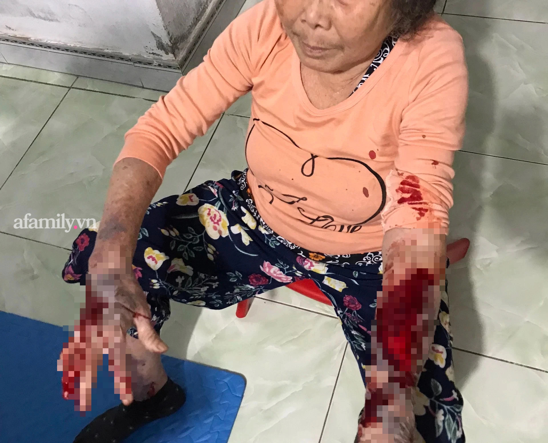 Bà H bị chảy nhiều máu