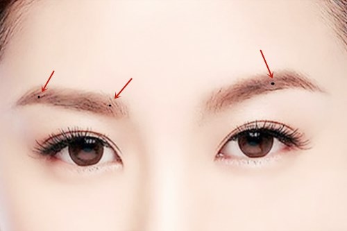 Who has moles in these positions, life is Who has moles in these positions, life is