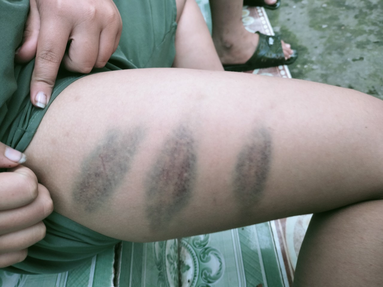 Người phụ nữ tố chồng cũ bạo hành con riêng ở Phú Thọ