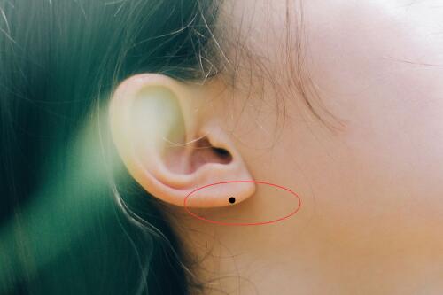 Ai sở hữu 1 trong 3 nốt ruồi ở những vị trí này, tương lai có thể kiếm được khối tài sản to lớn - Ảnh 1. Ai sở hữu 1 trong 3 nốt ruồi ở những vị trí này, tương lai có thể kiếm được khối tài sản to lớn - Ảnh 1.