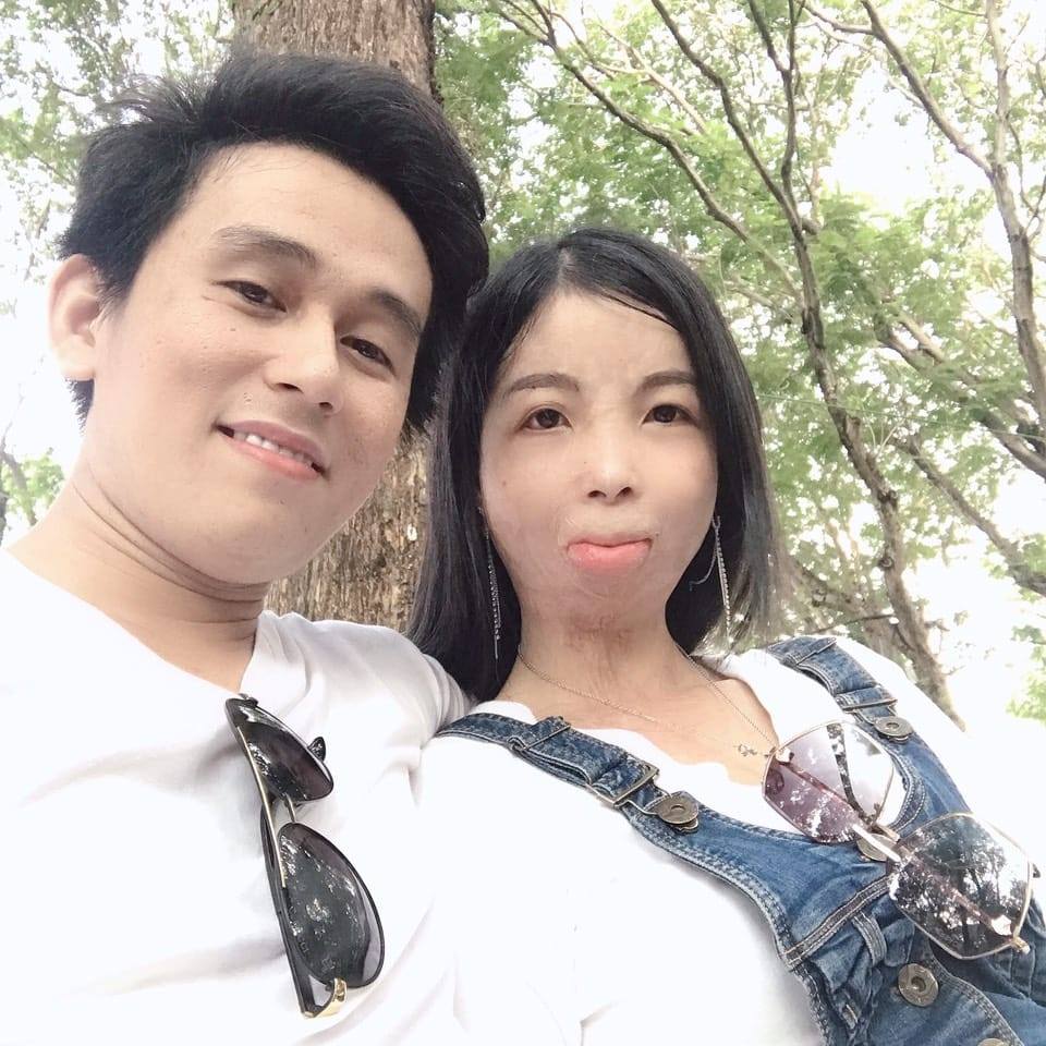 Chuyện tình cô gái bỏng 90% cơ thể và chàng shipper: Định mệnh đến từ một dòng trạng thái - Ảnh 4.