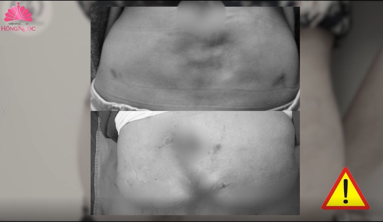 Fat loss injection - Photo 4.