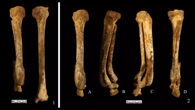 Bộ xương cổ đại tiết lộ hình phạt chặt chân phụ nữ Trung Quốc 3.000 năm trước - Ảnh 1.