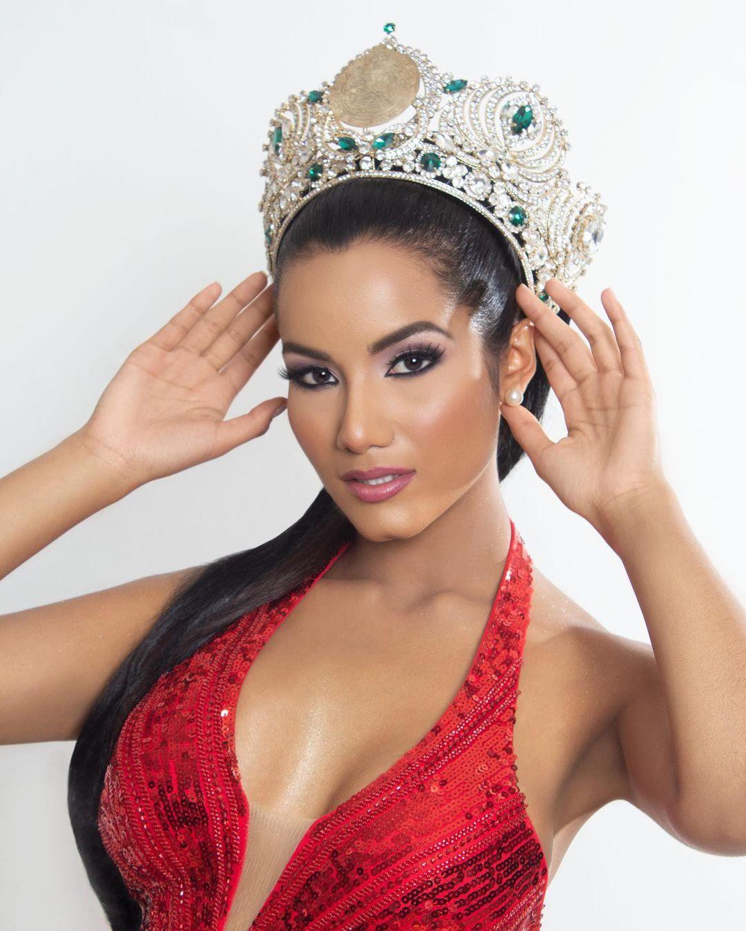 Tân Hoa hậu Siêu quốc gia Venezuela lộ diện: Body cực sexy nhưng gương mặt bị chê già trước tuổi - Ảnh 1.