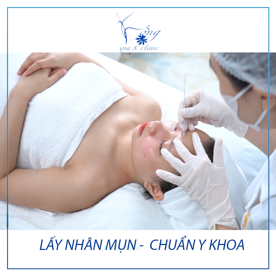 Bống Spa - Địa chỉ lấy nhân mụn chỉ 149k/buổi tại TP.HCM - Ảnh 1. Bống Spa - Địa chỉ lấy nhân mụn chỉ 149k/buổi tại TP.HCM - Ảnh 1.