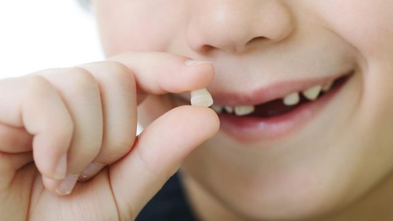 Nhổ răng sữa cho trẻ như thế nào để an toàn, bố mẹ có nên tự nhổ tại nhà cho con không? - Ảnh 5.