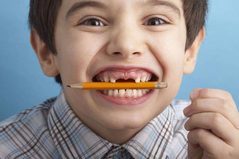 Những thói quen ảnh hưởng xấu đến sự phát triển của răng - Ảnh 3.