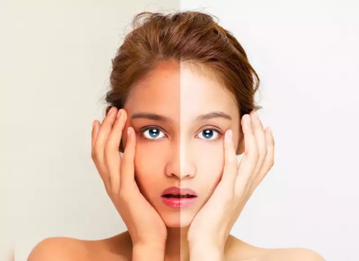 Cách chữa da cháy nắng hiệu quả nhất tại nhà - Ảnh 1. Cách chữa da cháy nắng hiệu quả nhất tại nhà - Ảnh 1.