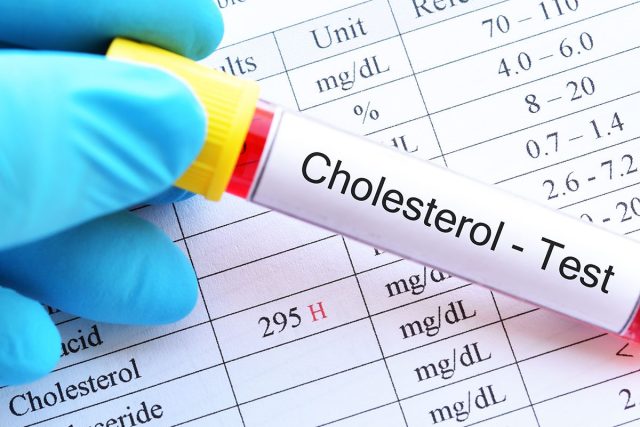 Dấu hiệu cho thấy bạn dễ bị cholesterol cao, nên ăn 3 loại rau hàng ngày để giảm cholesterol - Ảnh 4. Dấu hiệu cho thấy bạn dễ bị cholesterol cao, nên ăn 3 loại rau hàng ngày để giảm cholesterol - Ảnh 4.