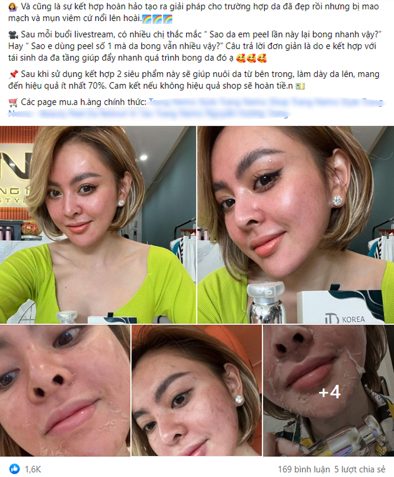 Từ vụ Trang Nemo hóa "mãng xà lột da": 3 nguyên tắc peel da chị em cần nhớ - Ảnh 2. Từ vụ Trang Nemo hóa "mãng xà lột da": 3 nguyên tắc peel da chị em cần nhớ - Ảnh 2.