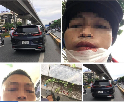 Nam tài lái xe công nghệ tố cáo tài xế ô tô đánh gãy răng vì không cho vượt - Ảnh 1.