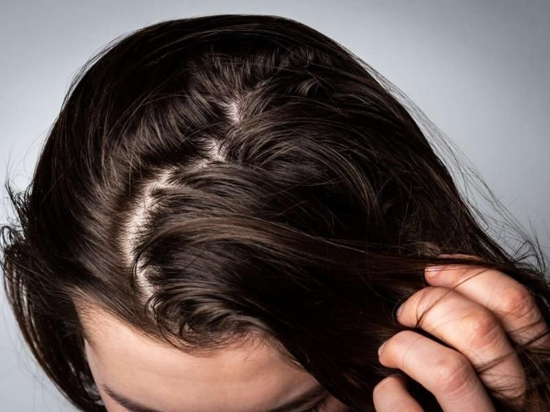 15 Dầu gội trị rụng tóc và kích thích mọc tóc nhanh hiệu quả  Rungtocvn