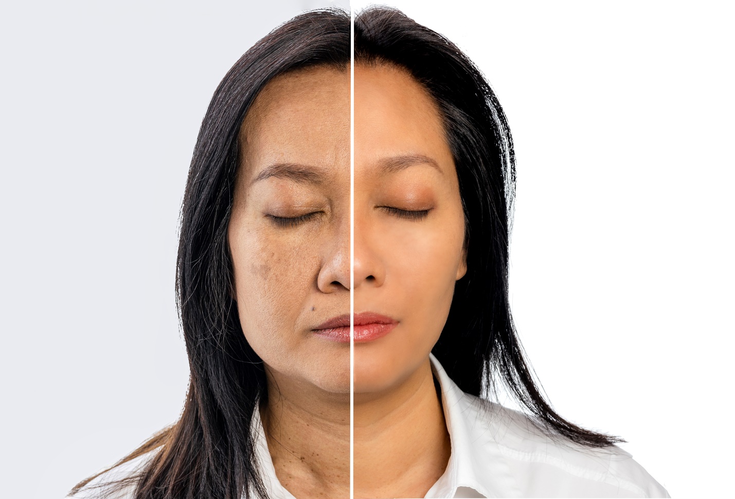Chuy&ecirc;n gia da liễu chia sẻ b&iacute; quyết gi&uacute;p chị em lu&ocirc;n sở hữu l&agrave;n da s&aacute;ng mịn, săn chắc sau tuổi 30 - Ảnh 2.