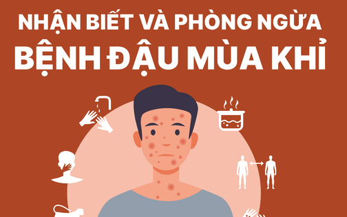 Infographic: Những điều cần biết về bệnh đậu mùa khỉ và cách phòng tránh