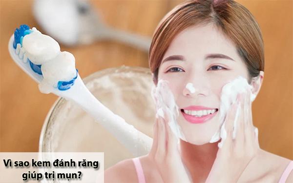Bôi kem đánh răng lên mụn có được không, có gây hại tới da không? - Ảnh 1. Bôi kem đánh răng lên mụn có được không, có gây hại tới da không? - Ảnh 1.