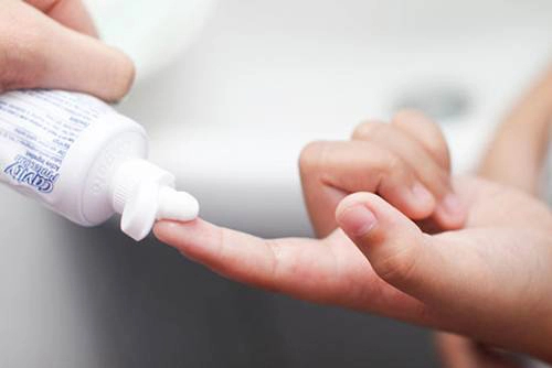 Bôi kem đánh răng lên mụn có được không, có gây hại tới da không? - Ảnh 2. Bôi kem đánh răng lên mụn có được không, có gây hại tới da không? - Ảnh 2.