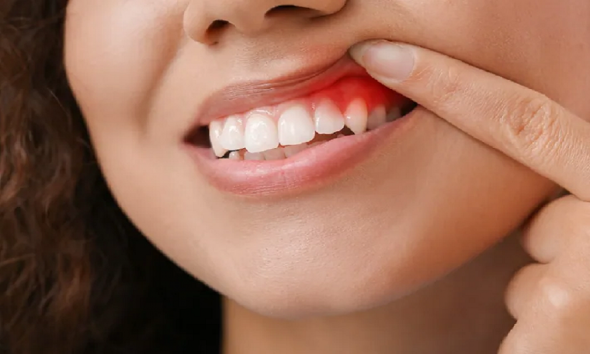5 lời khuyên chăm sóc răng miệng cho con bạn - Ảnh 3.