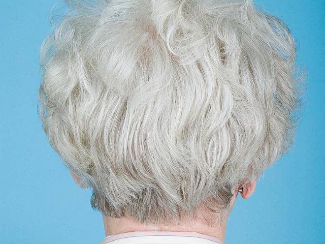 Nếu còn trẻ mà đã có tóc bạc thì cơ thể rất dễ thiếu vitamin này: Làm ngay 5 việc để ngăn ngừa tóc trắng xuất hiện - Ảnh 3.
