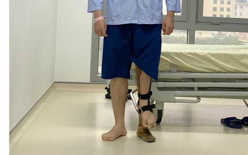Kỳ tích mới: Kéo dài chân tới... 18 cm cho chàng trai mắc dị tật chân cao chân thấp - Ảnh 1. Kỳ tích mới: Kéo dài chân tới... 18 cm cho chàng trai mắc dị tật chân cao chân thấp - Ảnh 1.