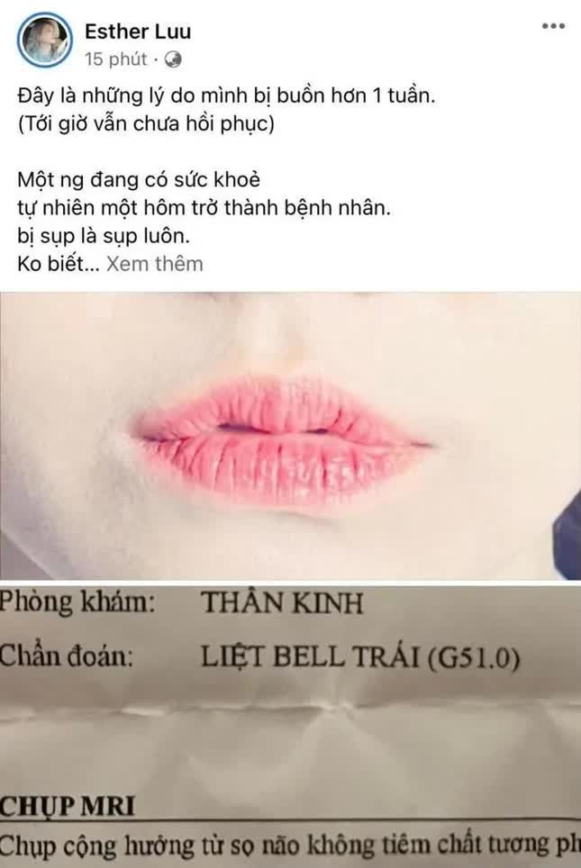 Hari Won bị liệt nửa mặt - Ảnh 2.