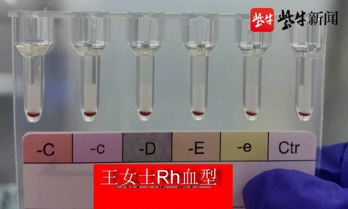 Trung Quốc phát hiện 2 người có ‘nhóm máu vàng' hiếm nhất Trái Đất - Ảnh 1.