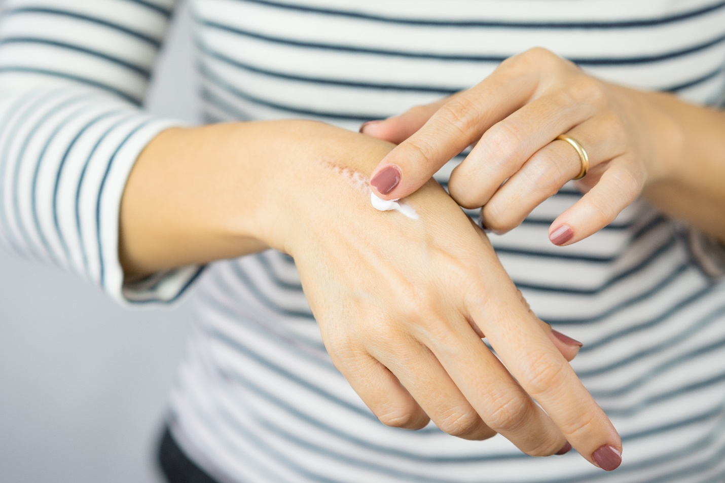 Bàn tròn thảo luận: Giải pháp chuyên sâu hỗ trợ giảm và mờ sẹo - Ảnh 1. Bàn tròn thảo luận: Giải pháp chuyên sâu hỗ trợ giảm và mờ sẹo - Ảnh 1.