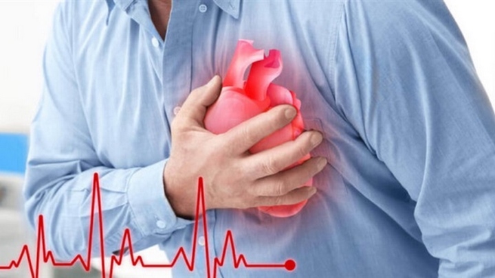 Bác sĩ hướng dẫn sơ cứu nhồi máu cơ tim đúng cách - Ảnh 1.