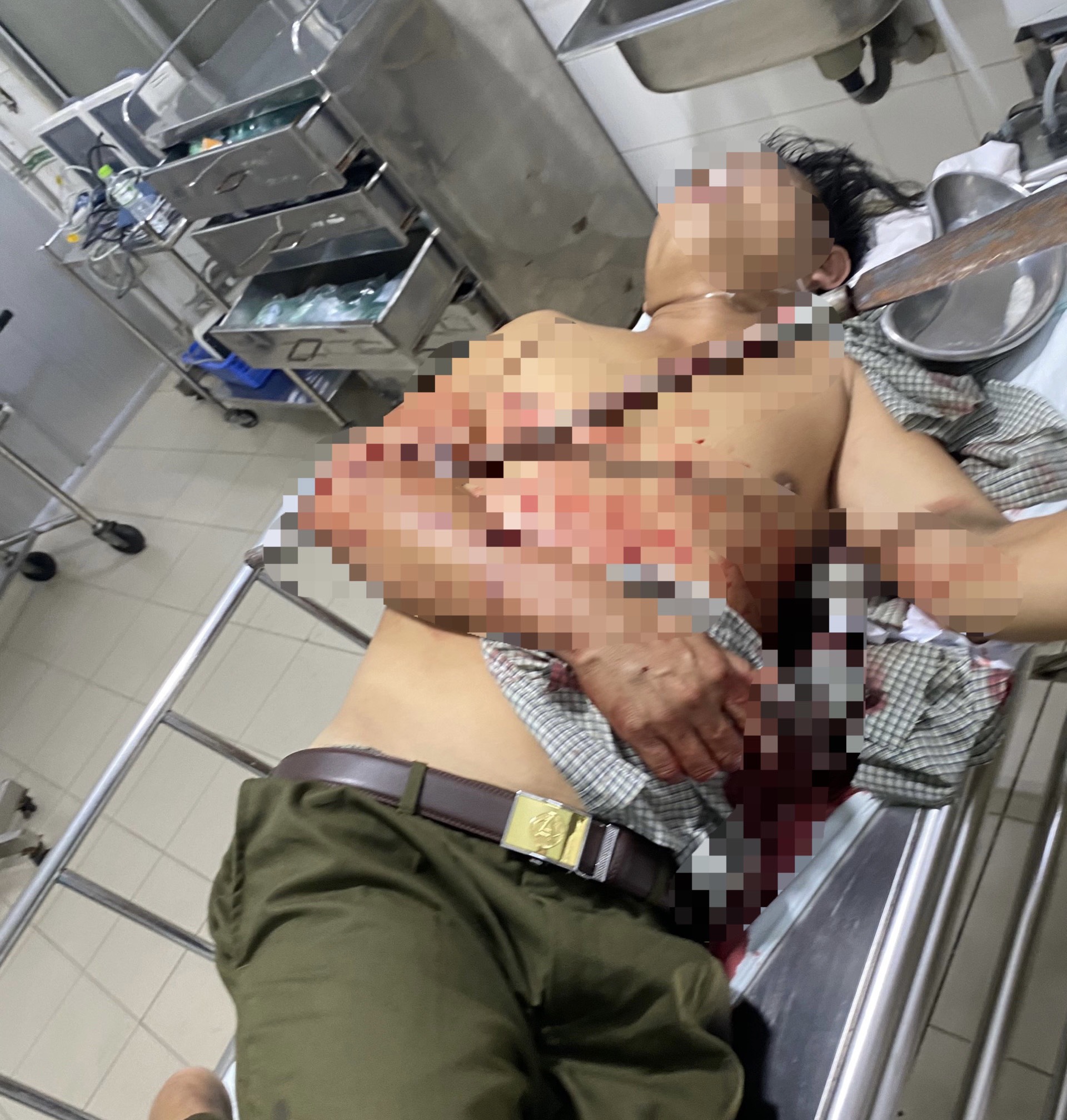 Ngăn chặn hỗn chiến, tổ trưởng dân phòng bị đâm xuyên cánh tay - Ảnh 1. Ngăn chặn hỗn chiến, tổ trưởng dân phòng bị đâm xuyên cánh tay - Ảnh 1.