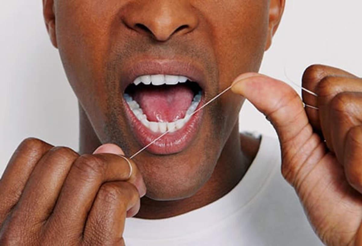 Các phương pháp làm trắng răng an toàn mới 2024
